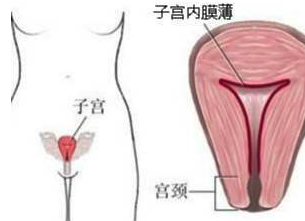 結婚5年懷孕2次都沒成功，我的孩子去哪了？