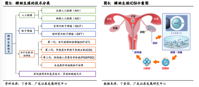 輔助生殖技術(shù)分類和ICSI單精子注射的流程操作